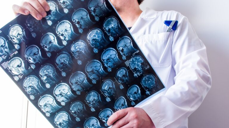 doctor is holding MRI brain scanning